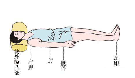 压疮的分期临床表现及其护理要点