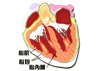 缩窄性心包炎