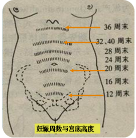 妊娠诊断练习题与考试要点